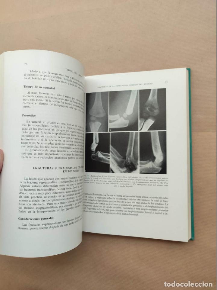 Libros: Cirug&iacute;a del Codo - &rdquo;SMITH, F.M&rdquo; - Foto 5