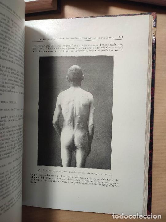 Libros: LOS PROGRESOS DE LA CL&Iacute;NICA 3 TOMOS. - V.A. - Foto 5