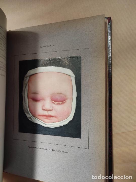 Libros: LOS PROGRESOS DE LA CL&Iacute;NICA 3 TOMOS. - V.A. - Foto 6