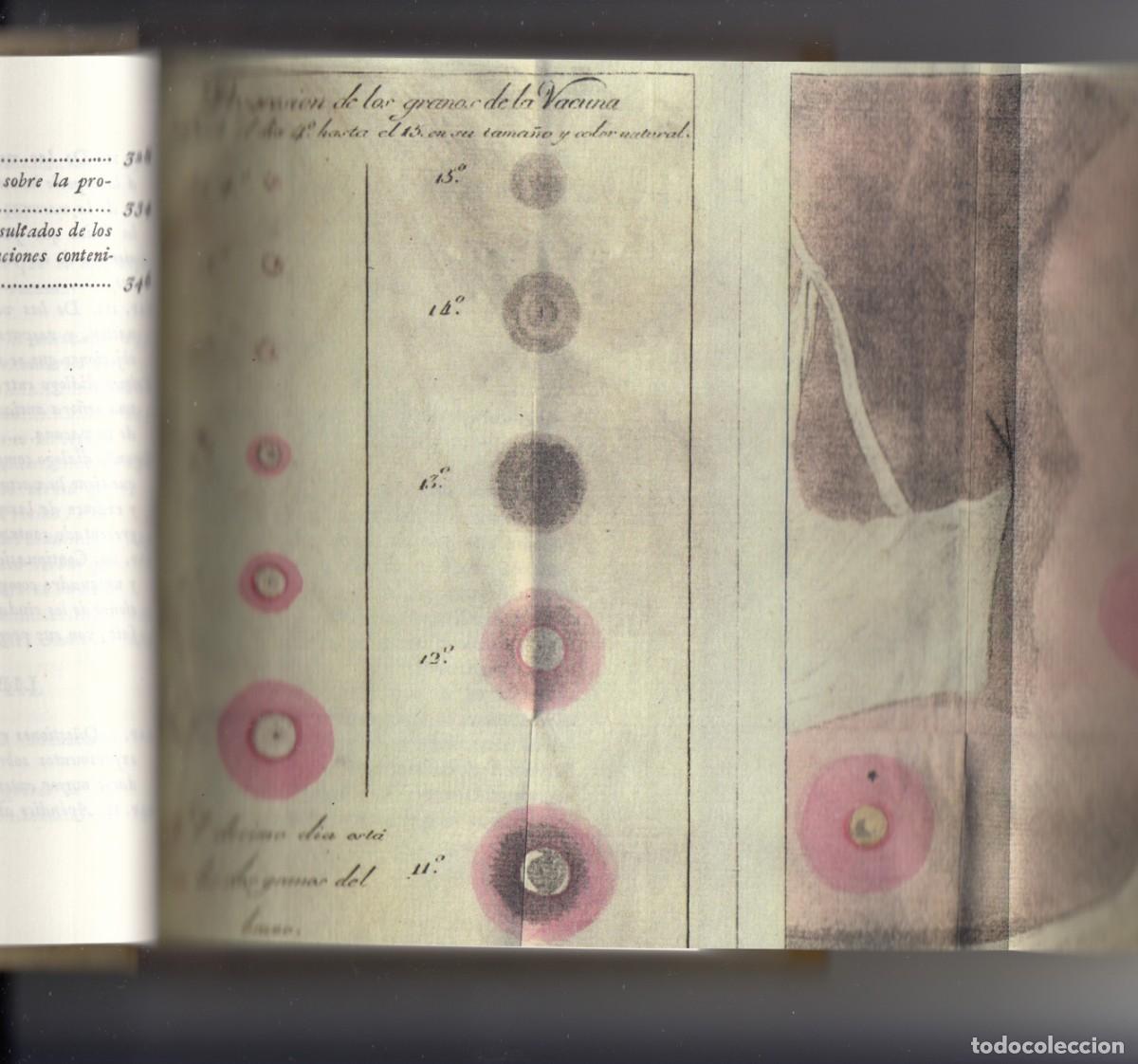 Libros: TRATADO HIST&Oacute;RICO Y PR&Aacute;CTICO DE LA VACUNA. MOREAU. FACS&Iacute;MIL ED.1804. ACZ - Foto 2
