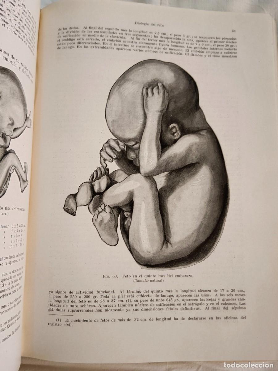 Libros: TRATADO DE OBSTETRICIA - TH. v. Jaschke - Foto 2