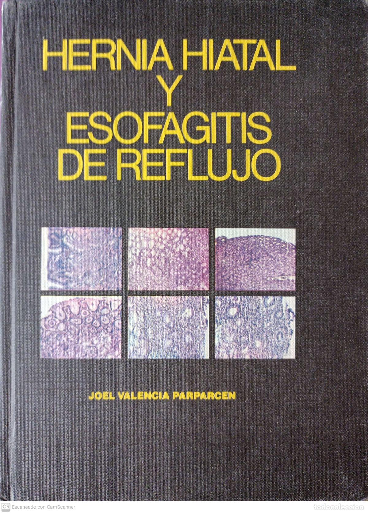 Libros: Hernia Hiatal y esofagitis de reflujo - Joel Valencia Parparcen - Foto 1