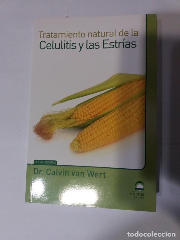 Libros: Tratamiento natural de la Celulitis y las Estrias - Dr. Calvin van Wert - Foto 1