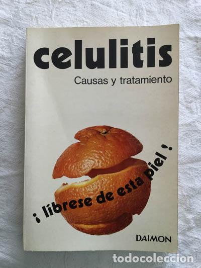 Libros: Celulitis. Causas y tratamiento - Gerard J. Leonard - Foto 1