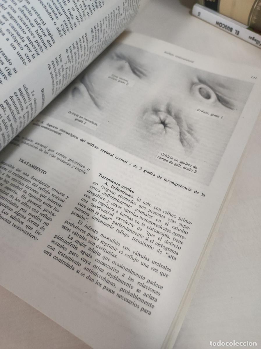 Libros: UROLOGIA GENERAL DONALD R SMITH - Foto 5