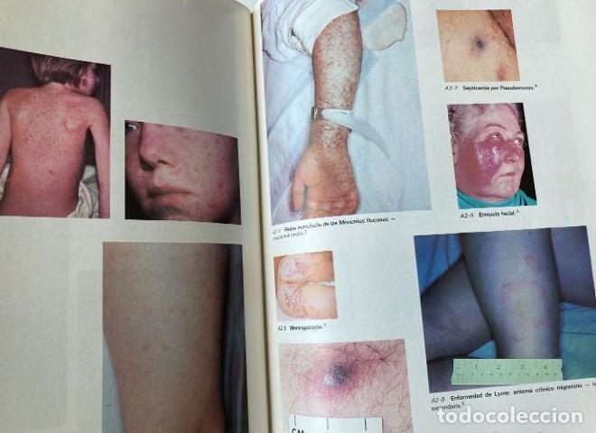 Libros: Principios de medicina interna. Harrison. - - Foto 2