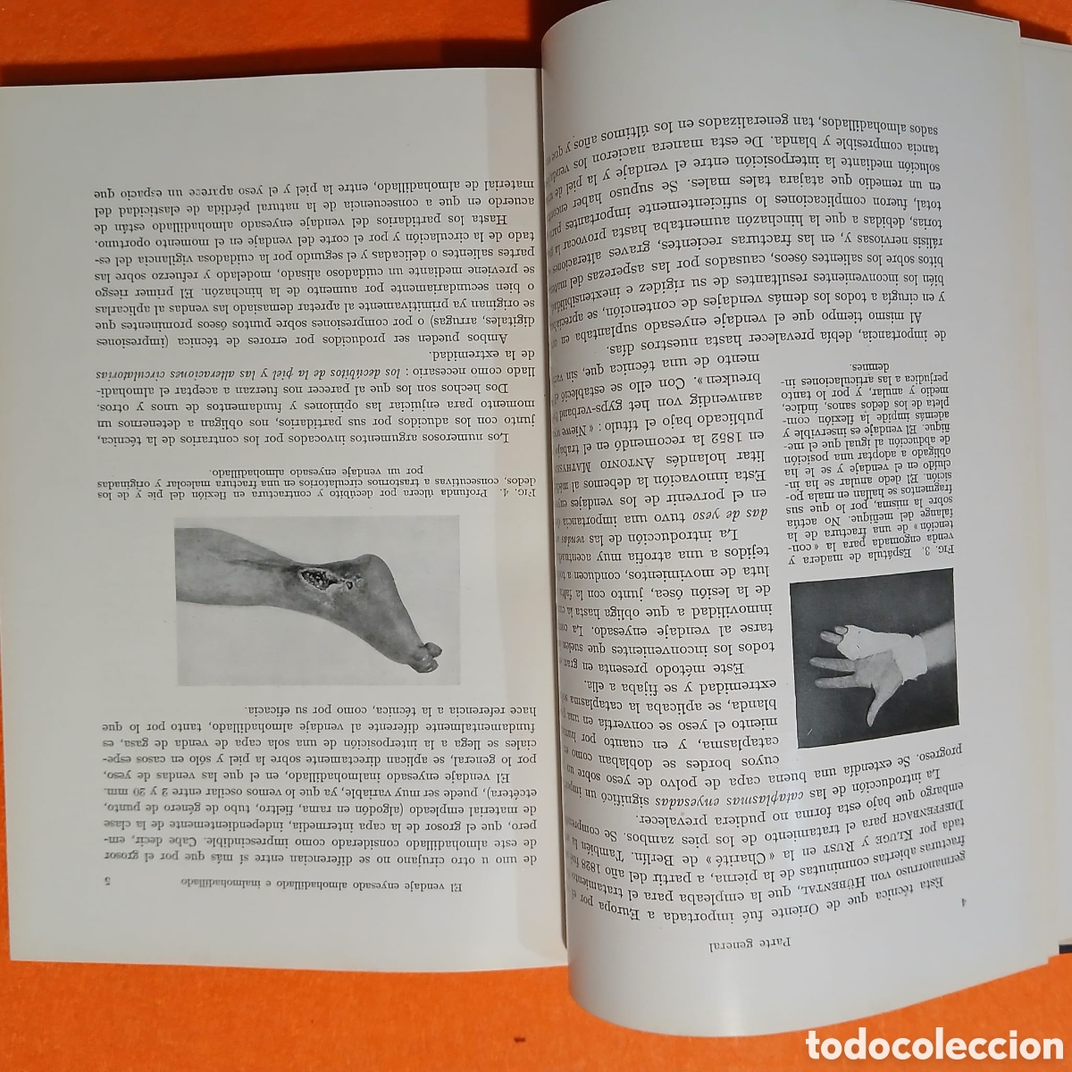 Libros: Tecnica del vendaje enyesado inalmohadillado - Foto 6