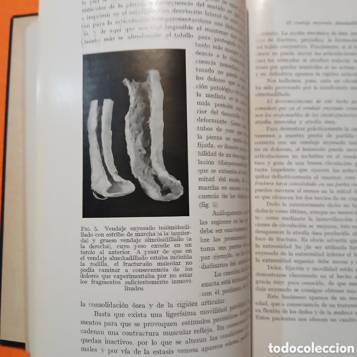 Libros: Tecnica del vendaje enyesado inalmohadillado - Foto 7