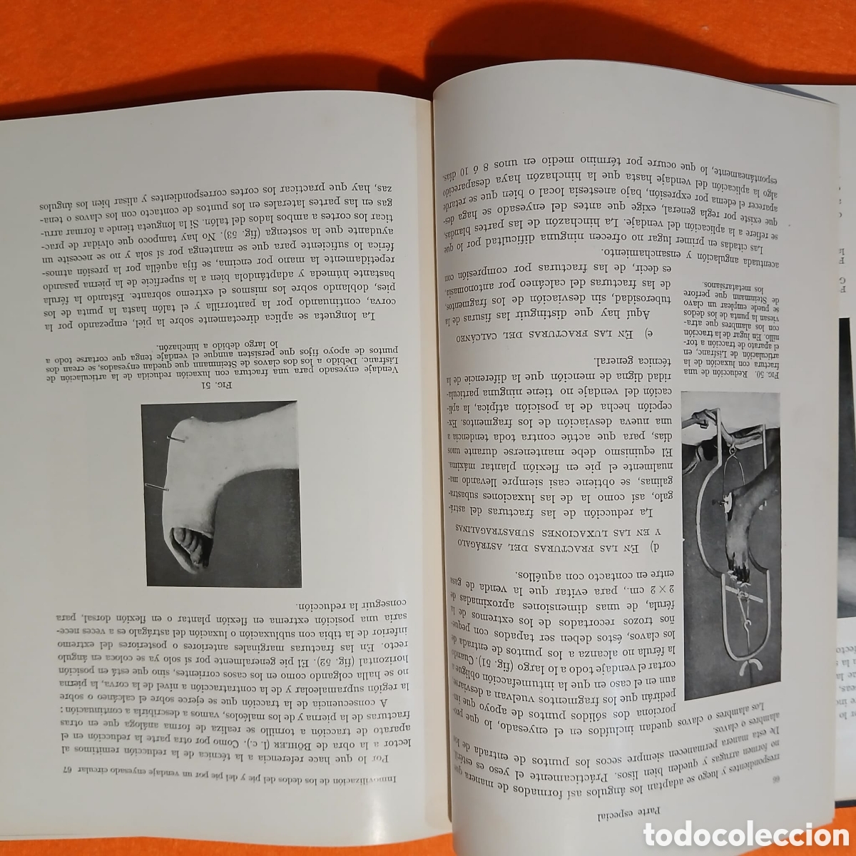 Libros: Tecnica del vendaje enyesado inalmohadillado - Foto 9