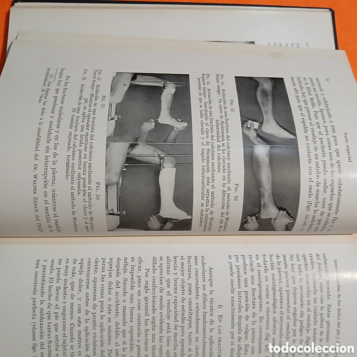 Libros: Tecnica del vendaje enyesado inalmohadillado - Foto 10
