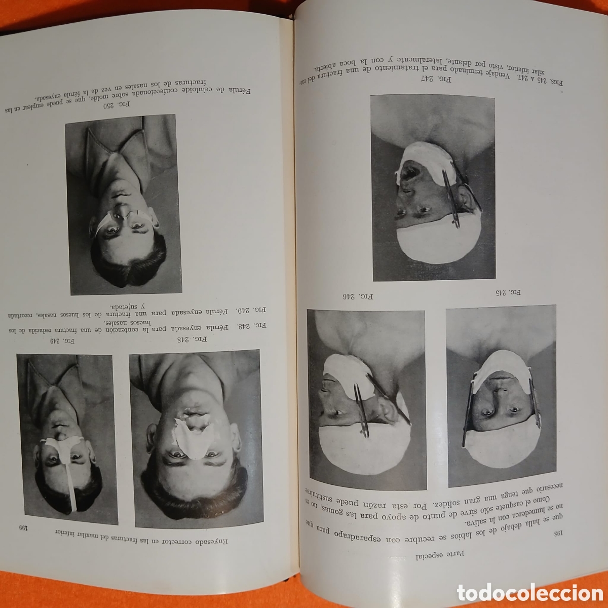 Libros: Tecnica del vendaje enyesado inalmohadillado - Foto 12