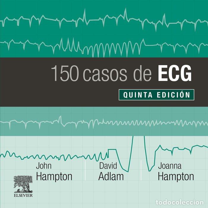 Libros: 150 CASOS DE ECG - AA,VV - Foto 1