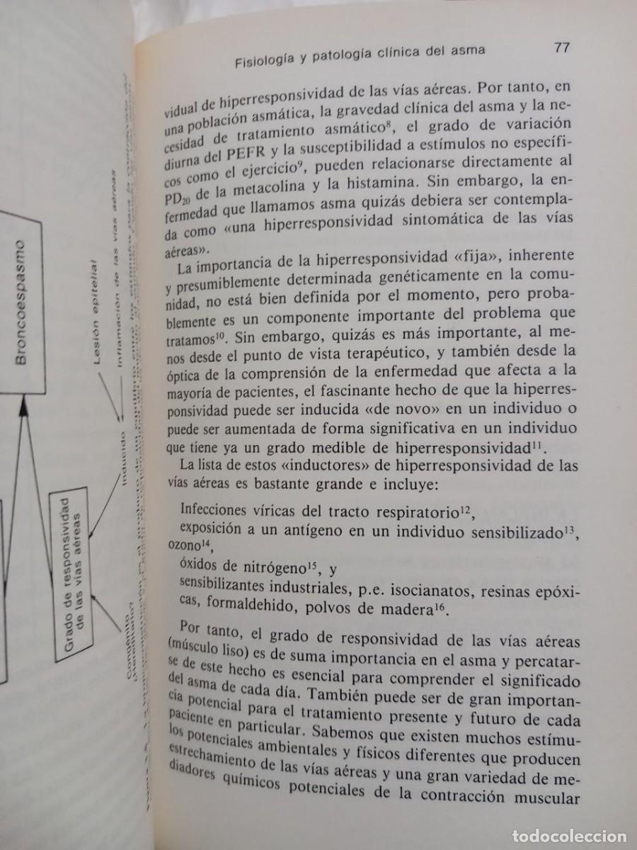 Libros: Asma. - JARIWALLA, G.: - Foto 4