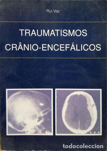 Libros: VAZ. (Rui) - TRAUMATISMOS CR&Acirc;NIO-ENCEF&Aacute;LICOS. - Foto 1