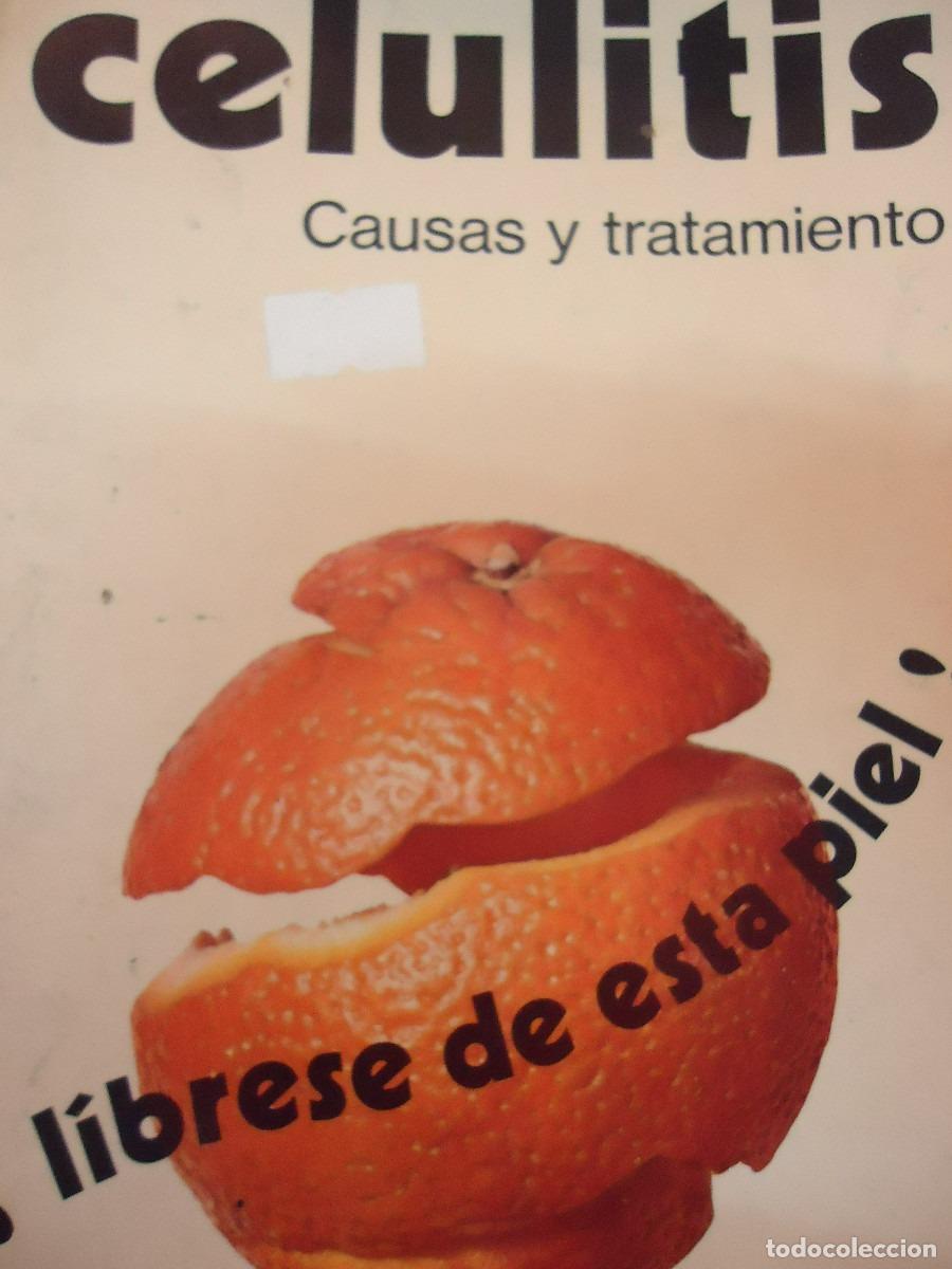 Libros: CELULITIS. CAUSAS Y TRATAMIENTO - VVAA - Foto 1