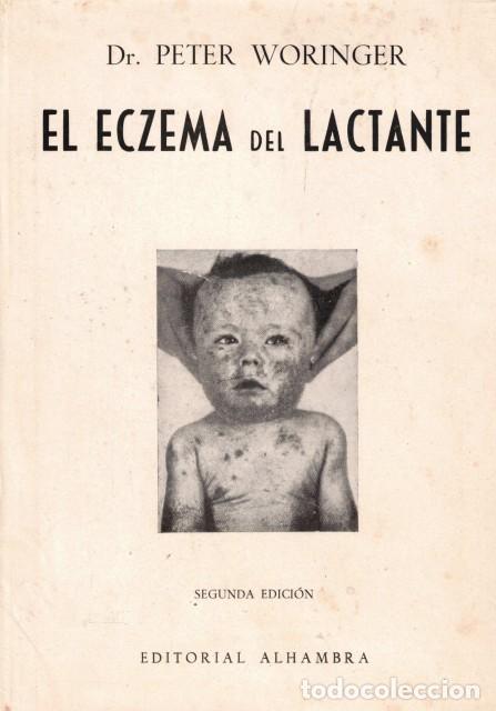Libros: El eczema del lactante - Woringer, Peter - Foto 1