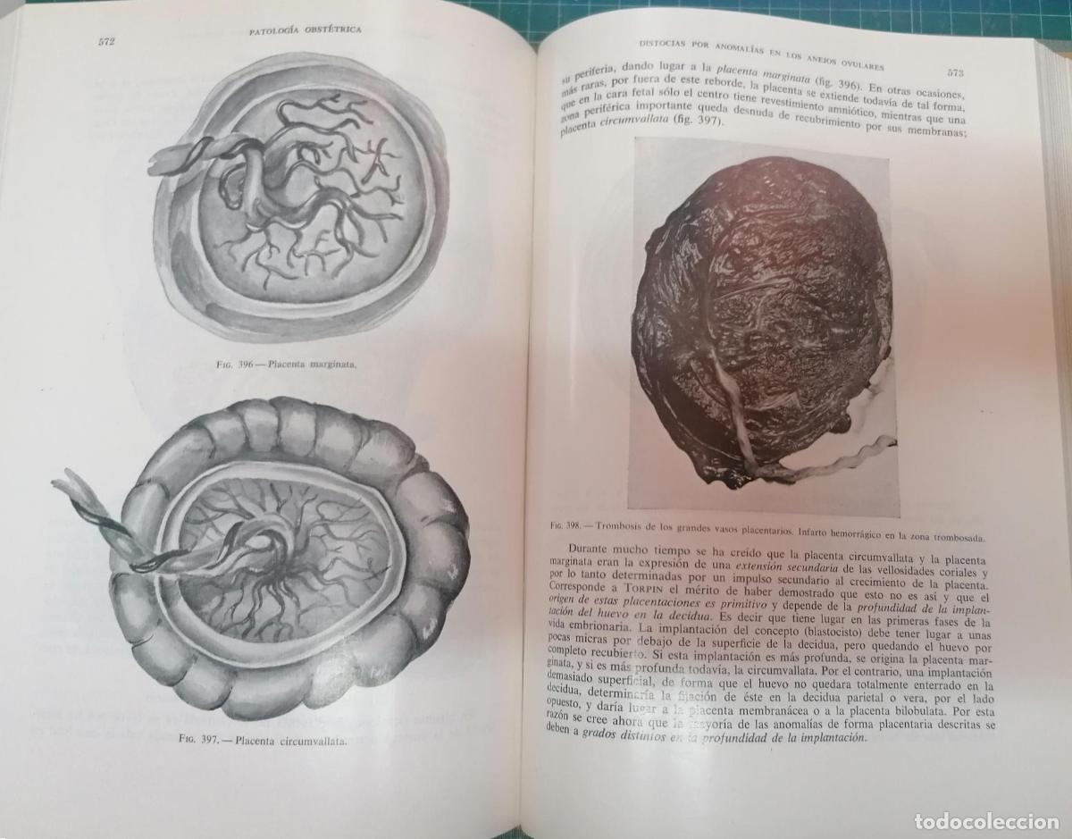 Libros: Botella Llusi&aacute;, Jos&eacute; - PATOLOG&Iacute;A OBST&Eacute;TRICA - Foto 2
