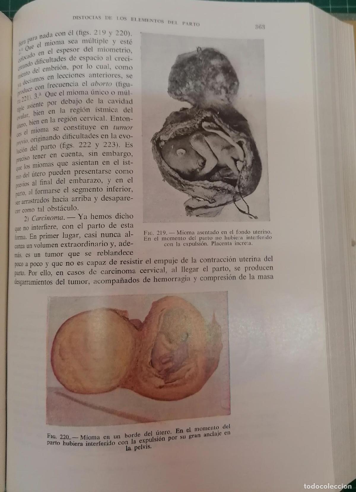 Libros: Botella Llusi&aacute;, Jos&eacute; - PATOLOG&Iacute;A OBST&Eacute;TRICA - Foto 5