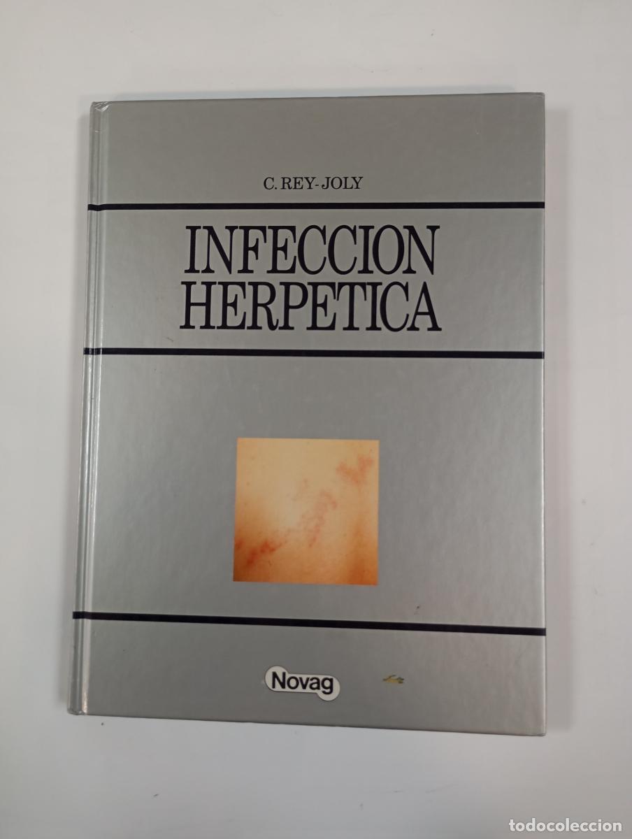 Libri di seconda mano: Infecci&oacute;n herp&eacute;tica. - C. Rey-Joly. TDK977