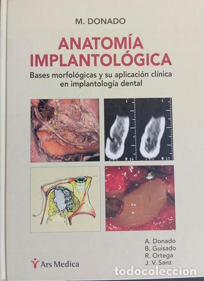 Libros: Anatom&iacute;a Implantol&oacute;gica- 9788497510165 - Foto 1