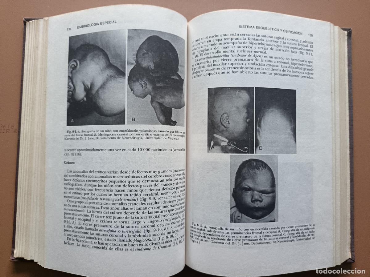 Libros: EMBRIOLOG&Iacute;A M&Eacute;DICA- J. LANGMAN- 1976 - Foto 10