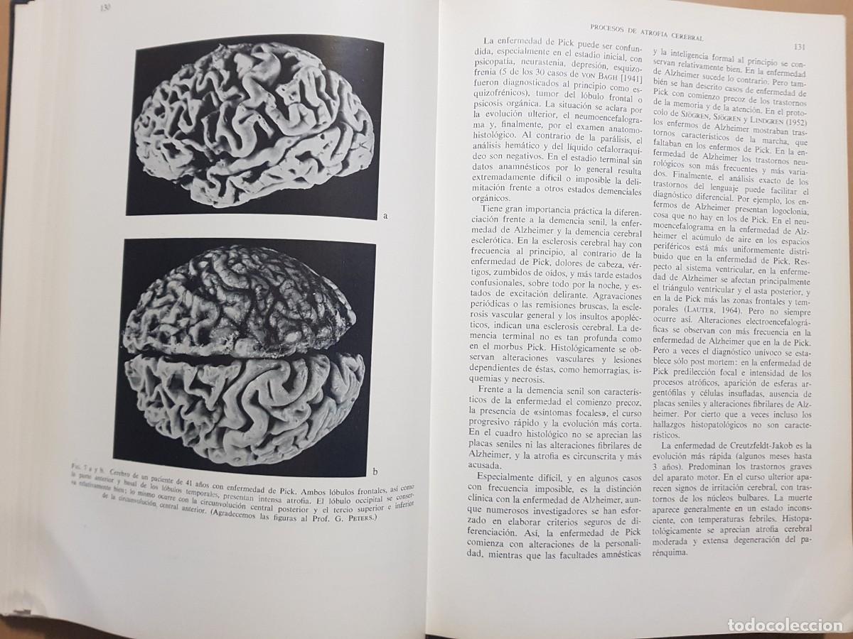 Libros: GEN&Eacute;TICA HUMANA V/2 - D.BECKER - ED. TORAY - 1966 (ILUST) - Foto 10