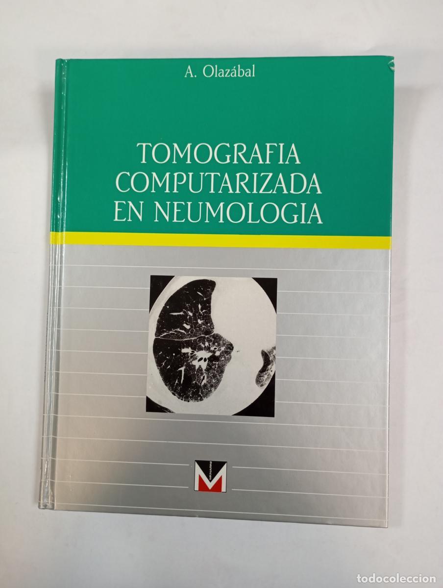 Libros: Tomograf&iacute;a computerizada en neumolog&iacute;a. - A. Olaz&aacute;bal. TDK