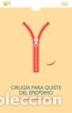 Libros: CIRUGIA PARA QUISTE DEL EPIDIDIMO - DEL BARRIO DONAIRE, MANUEL, - Foto 1