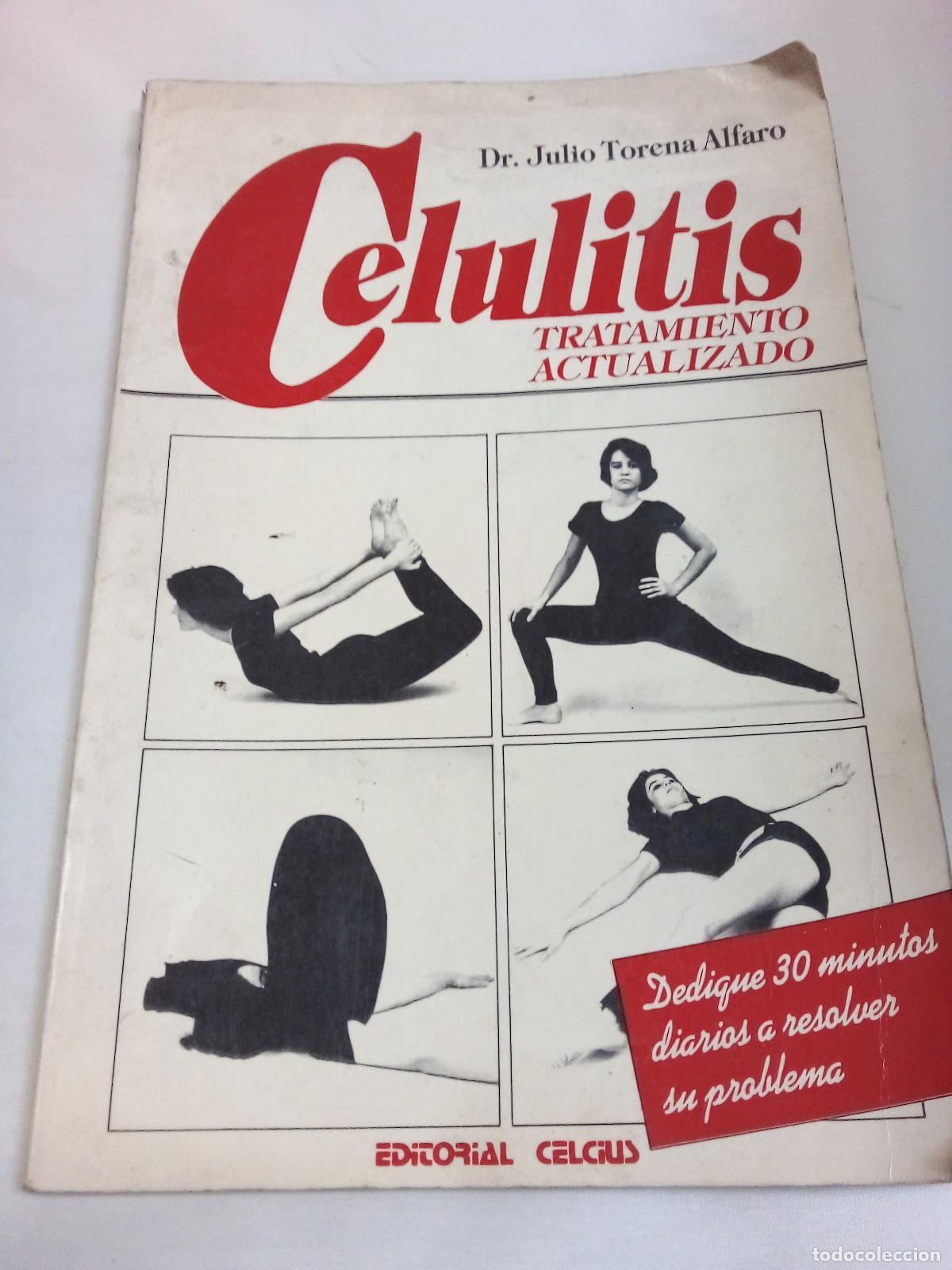 B&uuml;cher: Celulitis - Julio Torena Alfaro