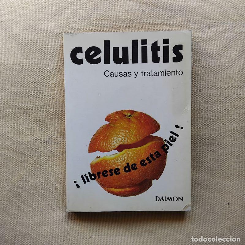 Libros: Celulitis. Causas y tratamiento - Gerard J. Leonard - Foto 1
