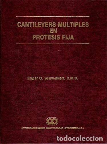 Libros: Cantilevers m&uacute;ltiples en pr&oacute;tesis fija- 9789806184091