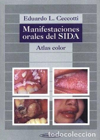 books: Manifestaciones orales del SIDA: Atlas color- 9789500604123