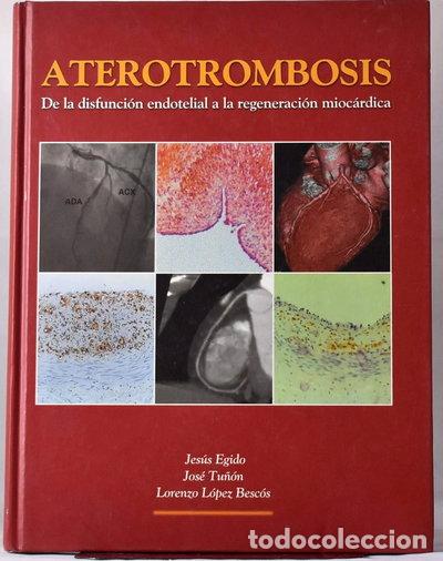 Libri di seconda mano: Aterotrombosis- 9788493339920