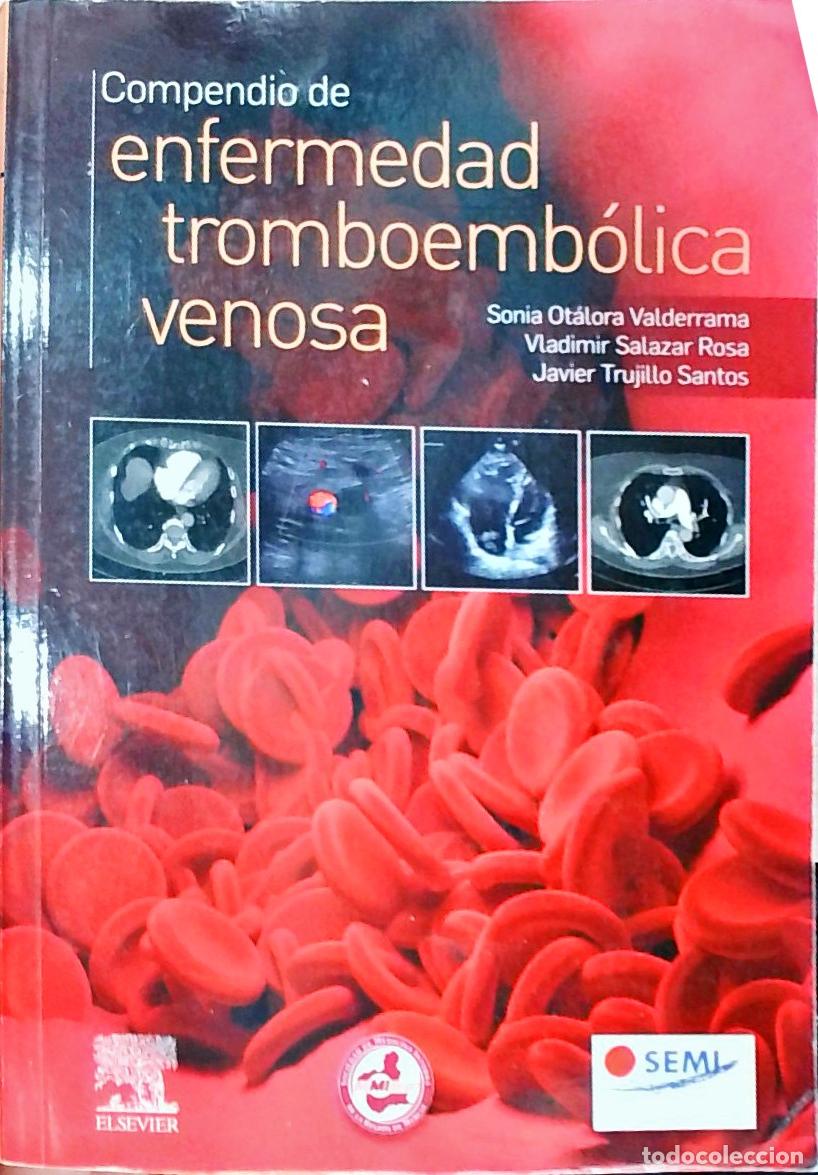 Livres: Compendio de enfermedad tromboemb&oacute;lica venosa - Sonia Ot&aacute;lora Valderrama; Vladimir Salazar Rosa, Jav