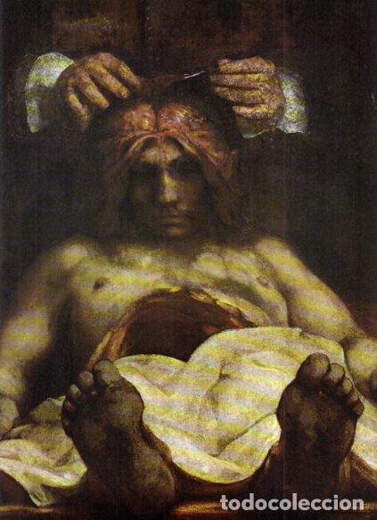 Livres: LAMINA V53286: Leccion de anatomia de Joan Reyman por Rembrandt. Detalle