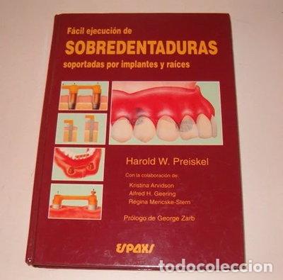 Libros: F&aacute;cil ejecuci&oacute;n de sobredentaduras soportadas por implantes y ra&iacute;ces- 9788471792846