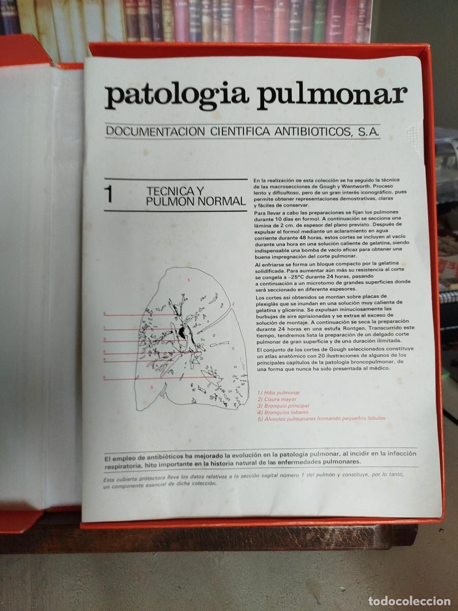 Libros: Patolog&iacute;a pulmonar: documentaci&oacute;n cient&iacute;fica. - VV. AA