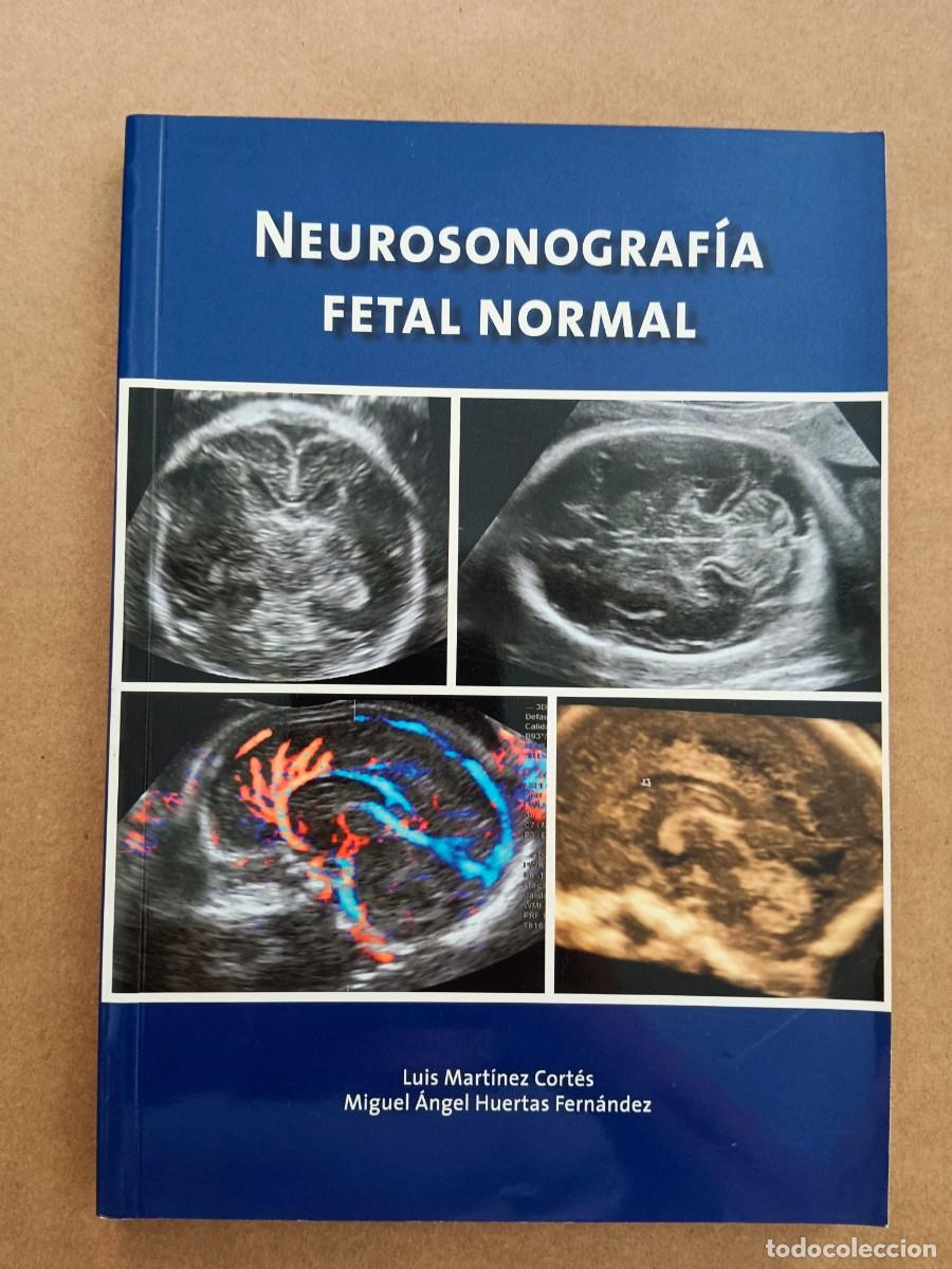 Livros em segunda m&atilde;o: NEUROSONOGRAFIA FETAL NORMAL - Luis Martinez Cortes - Miguel Angel Huertas Fernandez