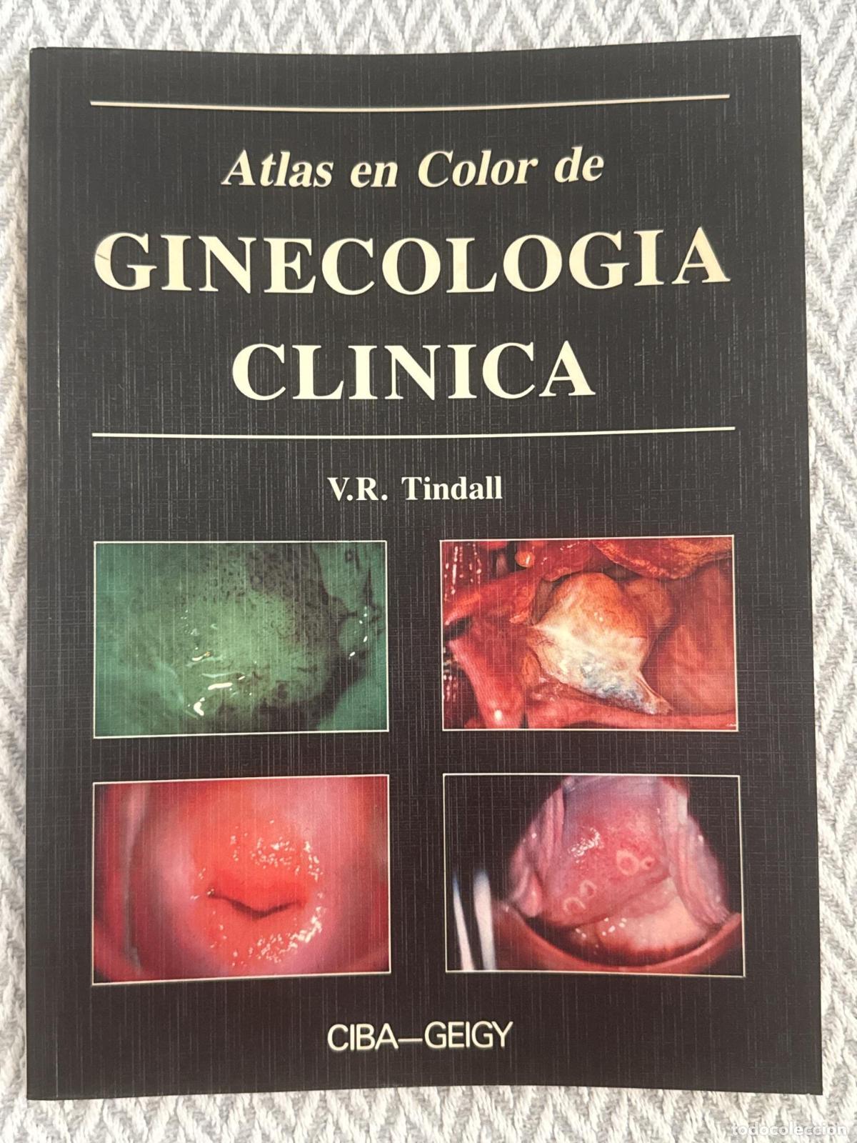 Libros: Atlas en color de ginecolog&iacute;a cl&iacute;nica - V.R. Tindall