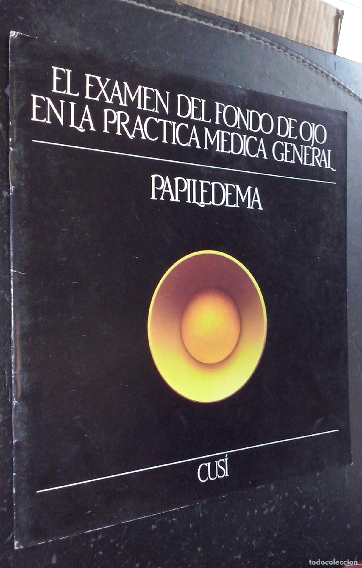 Libros: El examen del fondo de ojo en la pr&aacute;ctica m&eacute;dica general. Fasc&iacute;culo 3: Papiledema - AA. VV.: