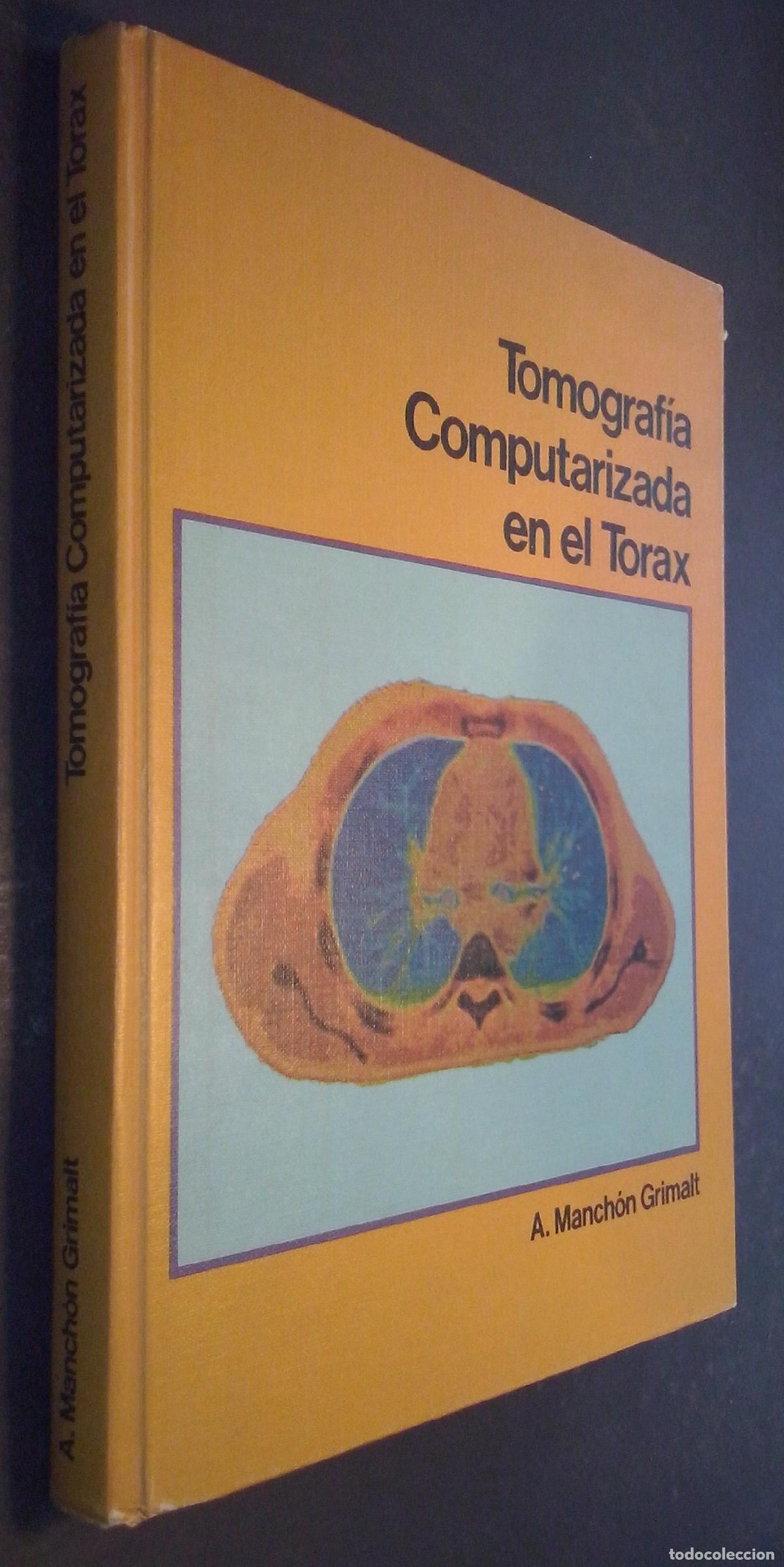 B&uuml;cher: Tomograf&iacute;a computarizada en el t&oacute;rax - MANCH&Oacute;N GRIMALT, A.: