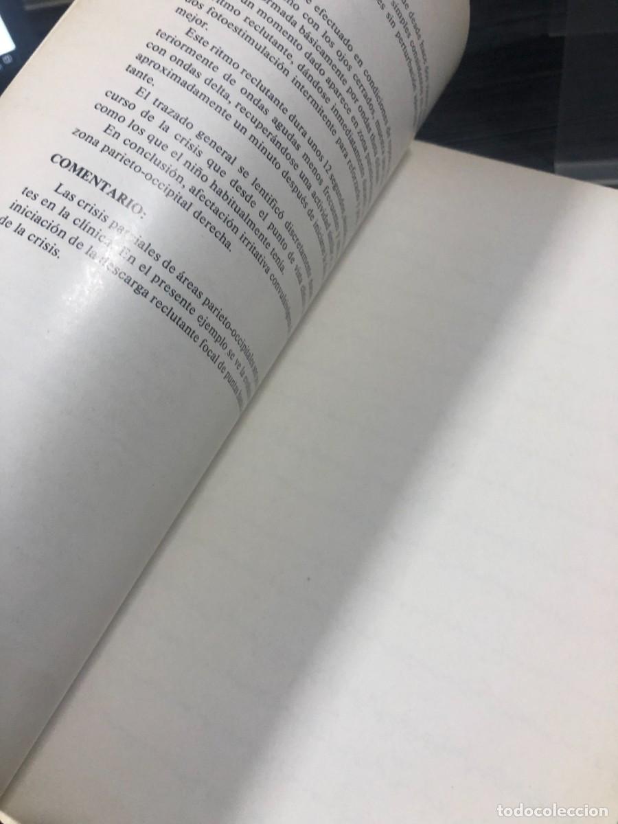 Libros: Atlas elemental de EEG en epilepsias Secci&oacute;n Cient&iacute;fica &rdquo;Roche&rdquo; - Foto 3