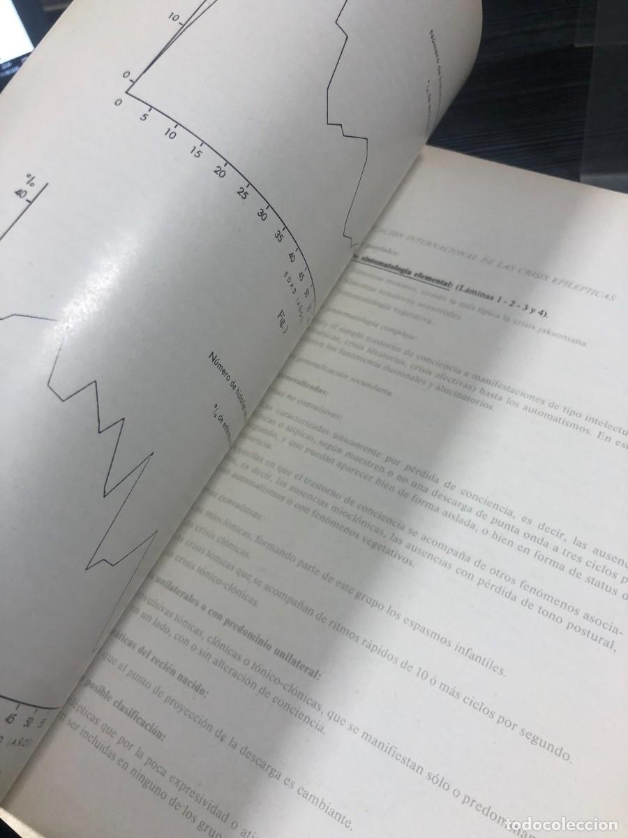 Libros: Atlas elemental de EEG en epilepsias Secci&oacute;n Cient&iacute;fica &rdquo;Roche&rdquo; - Foto 5