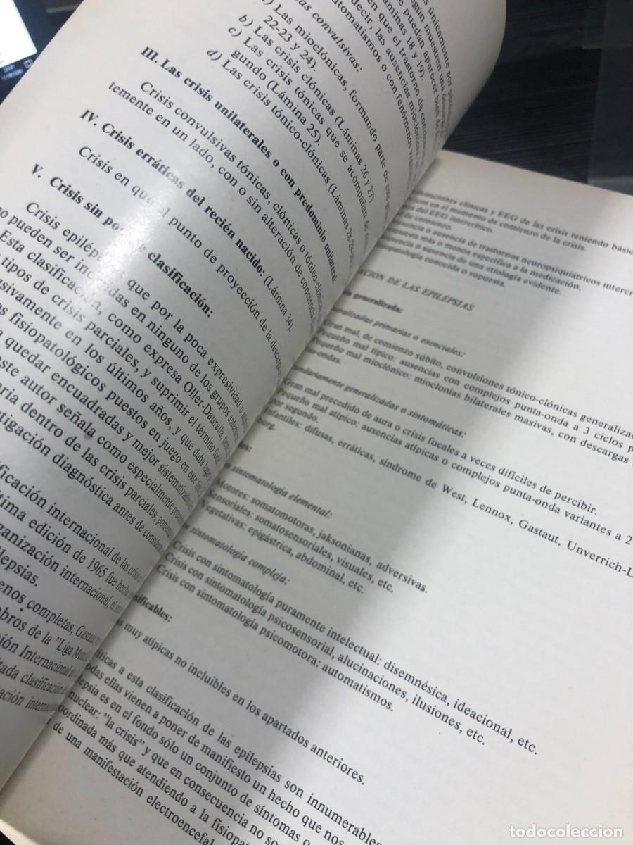 Libros: Atlas elemental de EEG en epilepsias Secci&oacute;n Cient&iacute;fica &rdquo;Roche&rdquo; - Foto 6