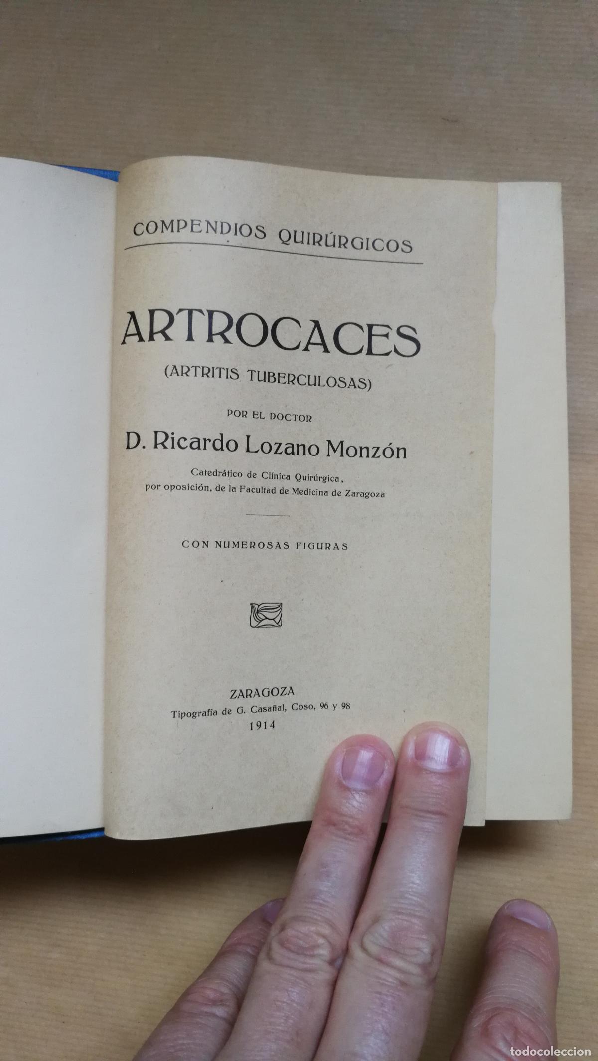 Livres: Artrocaces ( Artritis Tuberculosas ). Texto y Atlas. - Ricardo Lozano Monz&oacute;n