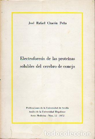 B&uuml;cher: ELECTROFORESIS DE LAS PROTE&Iacute;NAS SOLUBLES DEL CEREBRO DEL CONEJO.