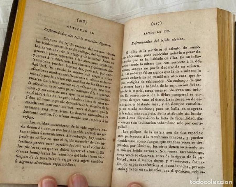 Libros: ANATOMIA PATOLOGICA - JAVIER BICHAT - Foto 4