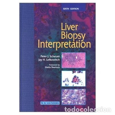 Libros: Liver Biopsy Interpretation- 9780702025020