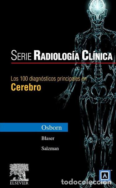 Libros: Serie Radiolog&iacute;a Cl&iacute;nica: Los 100 diagn&oacute;sticos principales en cerebro- 9788481747515