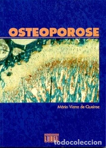 B&uuml;cher: Osteoporose- 9789727570430
